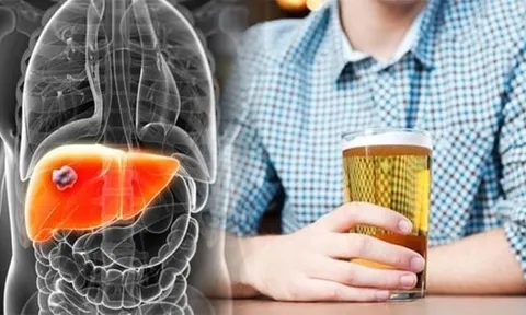 Uống cốc nước này tưởng lành mạnh nhưng đang phá nát gan, ngon mấy cũng đừng tiếc