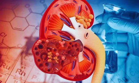3 dấu hiệu cảnh báo Suy Thận thường xuyên xuất hiện vào ban đêm