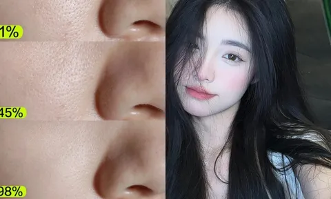Qua 30 tuổi, nhớ áp dụng 7 cách này để da căng mướt, thu nhỏ lỗ chân lông