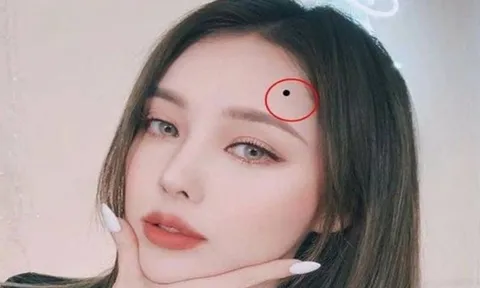 Nốt ruồi phát tài nằm ở đâu? Thầy tướng số tiết lộ: Ai sở hữu, tiền vào như nước, giàu sang khó tránh