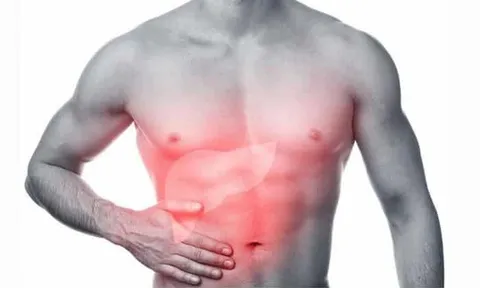 4 dấu hiệu cảnh báo gan của bạn đang kêu cứu ở giai đoạn nặng: Có 1 cũng nên đi khám sớm