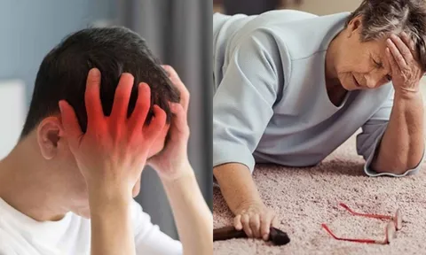 Đột quỵ ngày càng trẻ hóa: 30 giây nhận biết có thể cứu sống một mạng người
