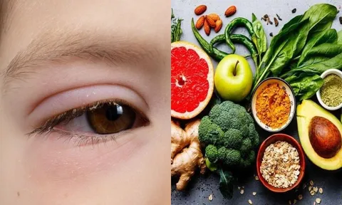 Mắt xuất hiện 3 dấu hiệu bất thường, coi chừng cholesterol trong máu quá cao: Khi rửa mặt nhất định phải chú ý