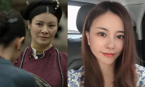 NSƯT Kim Oanh công khai diện mạo mới sau thẩm mỹ, gây bất ngờ vì khác lạ