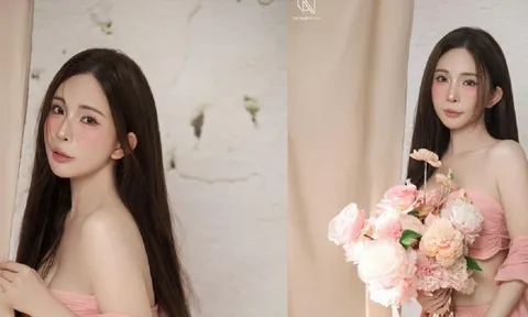 Quỳnh Nga vướng nghi vấn can thiệp dao kéo vì gương mặt khác lạ
