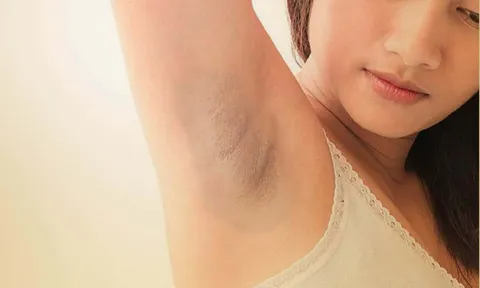7 mẹo là “cứu tinh” giúp bạn vừa trị thâm, vừa khử mùi hiệu quả