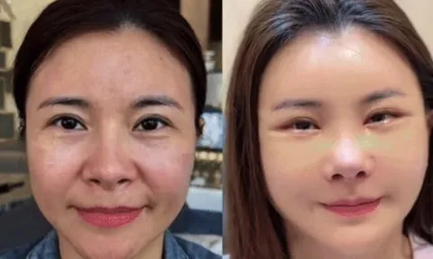 Kim Oanh lên tiếng sau khi gây tranh cãi vì phẫu thuật thẩm mỹ cả gương mặt