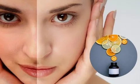 Vitamin C và những sai lầm thường gặp khi chăm sóc da
