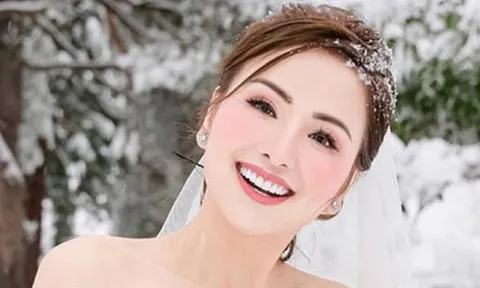 Diễm Hương lên tiếng khi bị chê sửa mũi, mặt cứng đờ