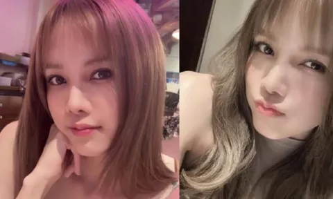 Thiều Bảo Trâm lên tiếng làm rõ nghi vấn bị biến chứng hậu 'dao kéo'