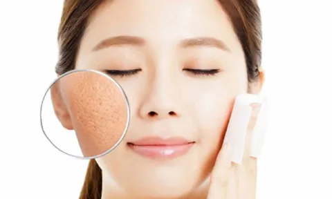 6 mẹo thu  lỗ chân lông như được “thu nhỏ”, giúp da trông mịn màng hơn