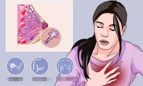 4 loại ung thư có tỷ lệ sống sót gần 100%, trong đó có ung thư vú – Đừng vội từ bỏ điều trị