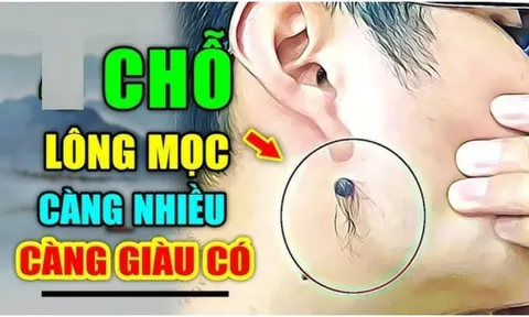 3 chỗ mọc lông Ngồi Không cũng có Tiền, số 1 nhiều người không biết lại nhổ đi