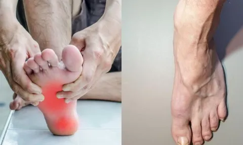 Hai bàn chân xuất hiện 5 dấu hiệu lạ, coi chừng gan đang 'kêu cứu': Hãy đi khám ngay đừng chủ quan
