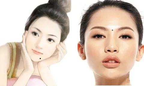 3 vị trí mọc nốt ruồi này báo hiệu số phú quý, cả đời phúc lộc dồi dào, tiền tài không bao giờ thiếu