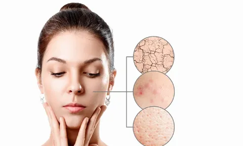 Nguyên tắc “sáng C – tối A” hồi sinh làn da nhiều khuyết điểm