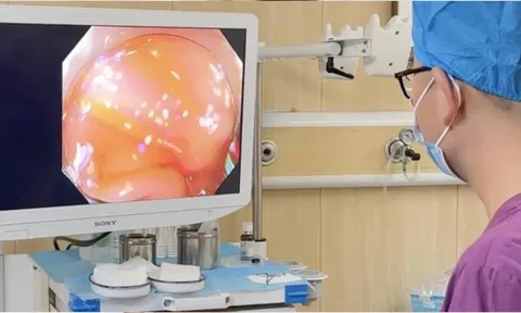 22 tuổi mắc ung thư kết tràng: Thói quen xấu đang âm thầm ‘bào mòn’ ruột non giới trẻ