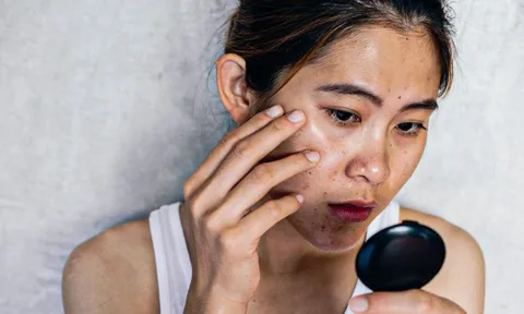 2 lưu ý cơ bản giúp cải thiện tình trạng da xỉn màu, sạm đen