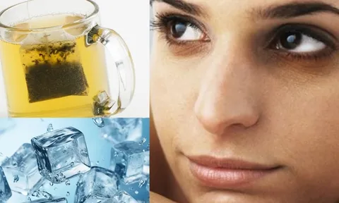 Cách giảm thâm quầng mắt chỉ cần trà và đá lạnh
