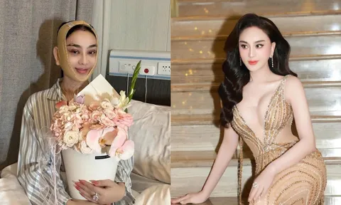 Lâm Khánh Chi gây chú ý với diện mạo sau phẫu thuật thẩm mỹ