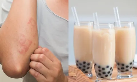 3 món ngọt âm thầm phá hủy lá gan, nhiều người Việt vẫn vô tư ăn hằng ngày