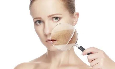 4 lỗi thường gặp khị trị nám khiến da ngày càng xuống cấp