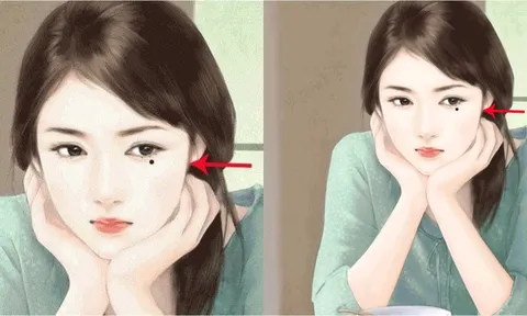 3 nốt ruồi may mắn: Ai có được cả đời sống trong nhung lụa, thật đáng chúc mừng