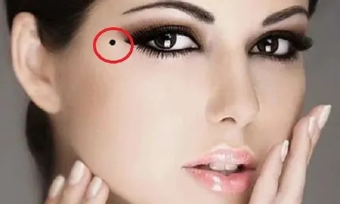 99% người không biết: Nốt ruồi ở đuôi mắt có thể là quý tướng, mang lại hạnh phúc viên mãn