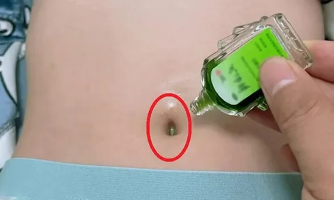 Bôi 1 giọt dầu gió vào rốn trước khi ngủ, tránh cả đống bệnh