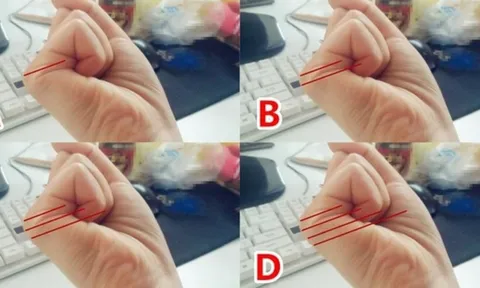 Nắm tay lại mà đếm đường chỉ tay: Ra đúng số này đời ăn không hết của