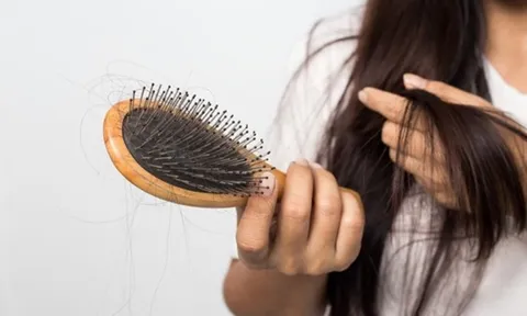 Mách nàng mẹo chăm sóc da đầu đúng cách trong mùa thu để ngăn ngừa rụng tóc