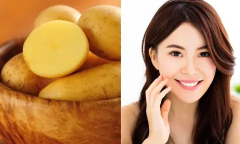 Khoai tây kết hợp với nguyên liệu này sẽ cho bạn đôi mắt tươi tắn, đánh bay quầng thâm