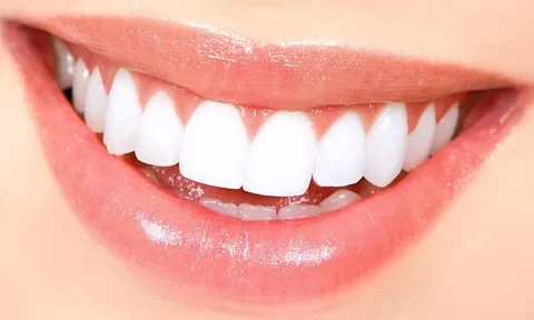 Mẹo “tự chế” giúp răng trắng sáng tự nhiên