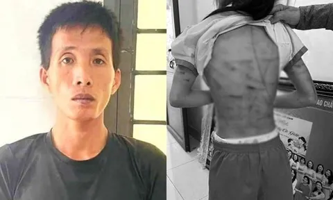 Vụ bé gái lớp 5 nghi bị bố dượng bạo hành: Hé lộ thêm nhiều tình tiết gây phẫn nộ dư luận