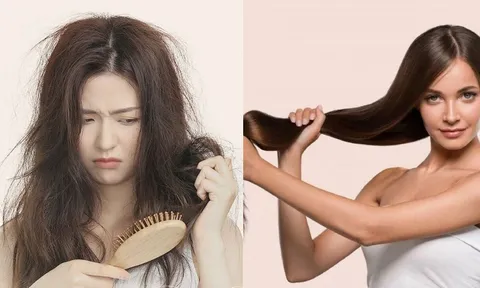 Cách giúp chống rụng tóc, khô tóc trong mùa đông khô hanh