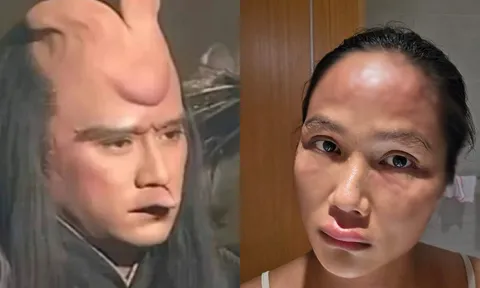 Mẹ bỉm H’Hen Niê gặp "bệnh lạ" sau sinh dù ở cữ sang chảnh nửa tỷ/tháng