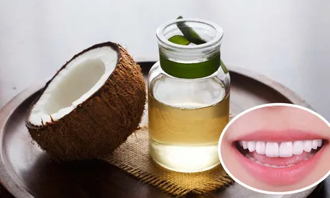 Súc miệng bằng dầu dừa có 3 lợi ích tuyệt vời, ai cũng cần