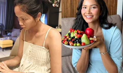Tình trạng của H'Hen Niê sau khi mắc bệnh lạ sau sinh