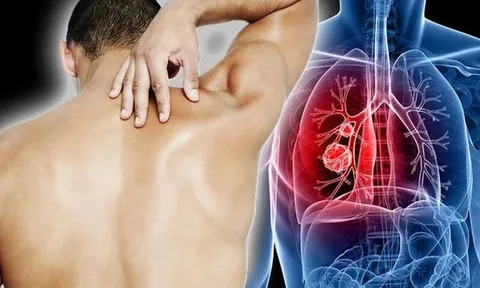 5 thứ đột nhiên xuất hiện chứng tỏ bệnh K "không rủ cũng tới"