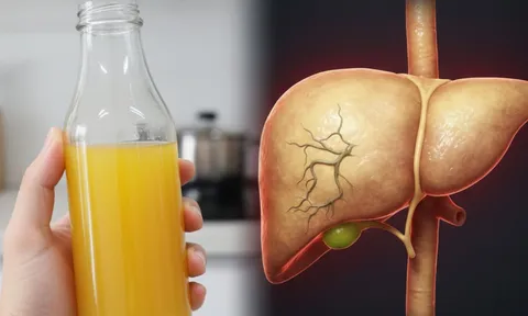 Đừng tưởng tốt cho sức khỏe, 3 loại trái cây này đang âm thầm “hủy hoại” lá gan