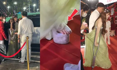 Hòa Minzy bất ngờ chống nạng, đi xe lăn tại sự kiện