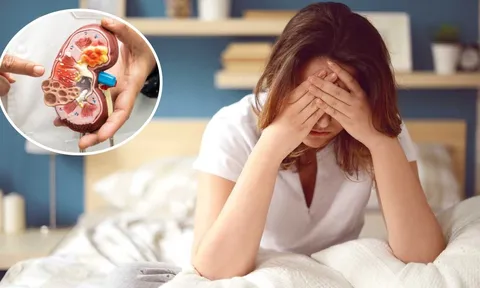 Cảnh báo 4 dấu hiệu sớm của suy thận, nhiều người tưởng bệnh vặt