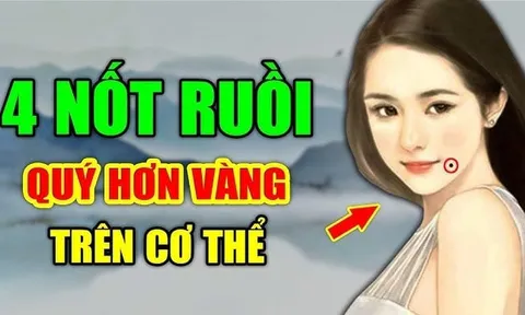 4 nốt ruồi quý hơn Vàng cực kỳ may mắn: Ai có được cả đời viên mãn