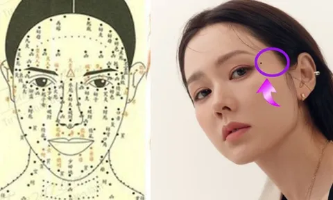 4 vị trí nốt ruồi “vàng” báo hiệu cuộc đời giàu sang