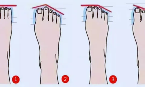 Xem hình dáng bàn chân, biết rõ tính cách tiềm ẩn của bạn