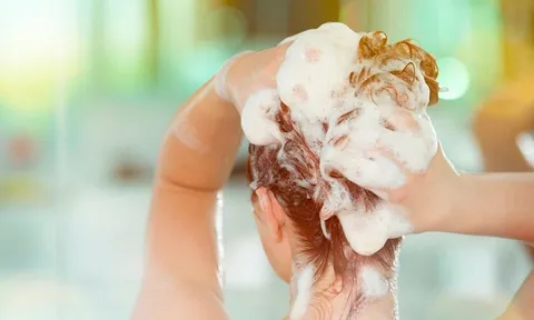 3 thói quen tưởng tốt nhưng lại khiến tóc yếu, gàu nhiều và dễ gãy rụng