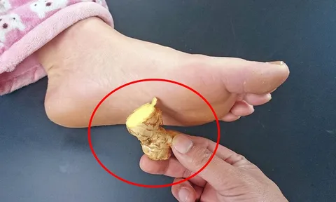4 lợi ích tuyệt vời khi đắp gừng vào lòng bàn chân vào buổi tối