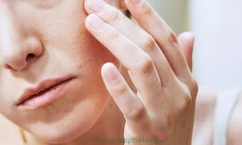 Mẹo để làn da không bị nếp nhăn mùa hanh khô