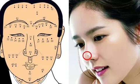 4 nốt ruồi chặn cửa Thần Tài: Ai có 1 cũng nên hóa giải