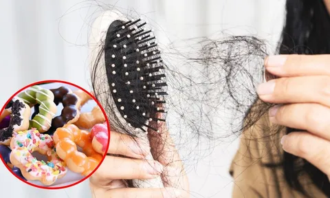 5 thực phẩm càng ăn càng gây rụng tóc, món số 1 nhiều người thích